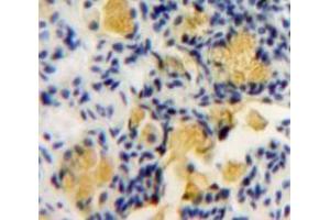 Used in DAB staining on fromalin fixed paraffin-embedded Bowels tissue (PKC zeta Antikörper  (AA 404-591))