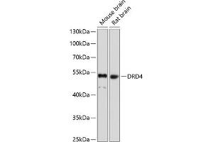 Western blot analysis of extracts of various cell lines, using DRD4 antibody (ABIN1679595, ABIN5663875, ABIN5663877 and ABIN6217338) at 1:1000 dilution. (DRD4 Antikörper  (AA 100-200))
