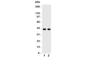 Western blot testing of CXCR5 antibody and Lane 1:  rat spleen (CXCR5 Antikörper  (C-Term))