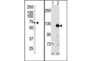 (LEFT)Western blot analysis of anti-EphA3 Pab in CHO cell lysate. (EPH Receptor A3 Antikörper  (C-Term))