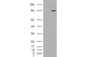 Western Blotting (WB) image for anti-Serine/threonine-Protein Phosphatase 4 Regulatory Subunit 3A (SMEK1) antibody (ABIN5905179) (SMEK1 Antikörper)