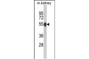 Western blot analysis of CAT Antibody in mouse kidney tissue lysates (35ug/lane) (Catalase Antikörper  (AA 152-180))