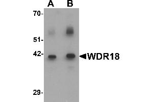 Western blot analysis of WDR18 in rat lung tissue lysate with WDR18 antibody at (A) 0. (WDR18 Antikörper  (C-Term))
