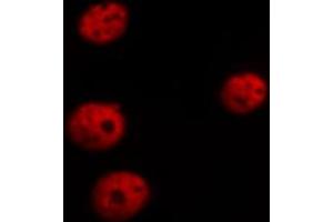 ABIN6267526 staining HepG2 cells by ICC/IF. (GATA4 Antikörper  (pSer105))