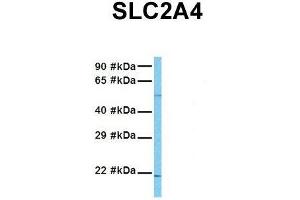 Host:  Rabbit  Target Name:  SLC2A4  Sample Tissue:  Human MCF7  Antibody Dilution:  1. (GLUT4 Antikörper  (N-Term))