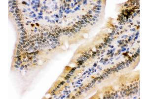 Immunohistochemistry (Paraffin-embedded Sections) (IHC (p)) image for anti-Ubiquitin-Like with PHD and Ring Finger Domains 2, E3 Ubiquitin Protein Ligase (UHRF2) (AA 15-54), (N-Term) antibody (ABIN3044559)