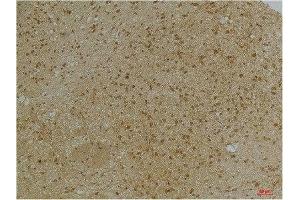 Immunohistochemical analysis of paraffin-embedded Mouse BrainTissue using KCNN2(SK2) Rabbit pAb diluted at 1:200.