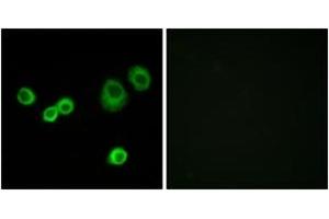 Immunofluorescence analysis of MCF7 cells, using Cytochrome c-type Heme Lyase Antibody. (HCCS Antikörper  (AA 81-130))