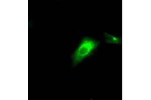 Image no. 6 for anti-Lipase, Endothelial (LIPG) antibody (ABIN1499169)