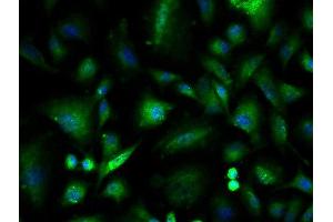 Immunofluorescence (Cultured Cells) (IF (cc)) image for anti-Integrin-Linked Kinase (ILK) (AA 301-400) antibody (ABIN727800)