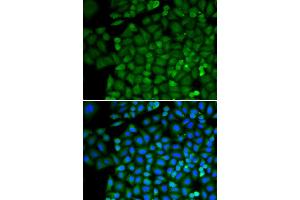 Immunofluorescence analysis of HeLa cell using SELENBP1 antibody. (SELENBP1 Antikörper)