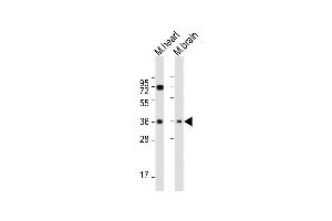 All lanes : Anti-HUN-LDHB at 1:2000 dilution Lane 1: Mouse heart whole cell lysate Lane 2: Mouse brain whole cell lysate Lysates/proteins at 20 μg per lane. (LDHB Antikörper  (AA 220-250))