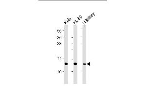 All lanes : Anti-ND4L Antibody (C-term) at 1:2000 dilution Lane 1: Hela whole cell lysate Lane 2: HL-60 whole cell lysate Lane 3: Human kidney lysate Lysates/proteins at 20 μg per lane. (MT-ND4L Antikörper  (C-Term))