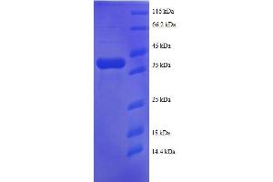 SDS-PAGE (SDS) image for Ribosomal Protein S25 (RPS25) (AA 1-125), (full length) protein (GST tag) (ABIN7479170)