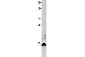 Gel: 12 % SDS-PAGE, Lysate: 40 μg, Lane: Mouse brain tissue, Primary antibody: ABIN7191217(KISS1 Antibody) at dilution 1/100, Secondary antibody: Goat anti rabbit IgG at 1/8000 dilution, Exposure time: 20 seconds