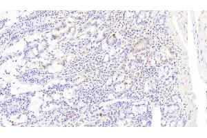 Detection of DR5 in Human Small intestine Tissue using Polyclonal Antibody to Death receptor 5 (DR5) (TNFRSF10B Antikörper  (AA 234-435))