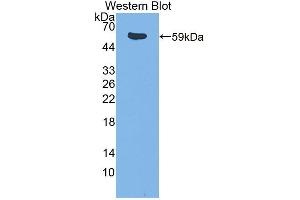 Western blot analysis of the recombinant protein. (ITK Antikörper  (AA 368-625))
