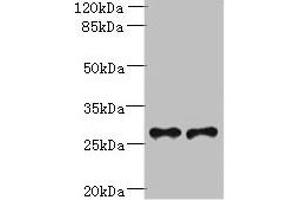 Western blot All lanes: Trem2 antibody at 6 μg/mL Lane 1: Mouse liver tissue Lane 2: THP-1 whole cell lysate Secondary Goat polyclonal to rabbit IgG at 1/10000 dilution Predicted band size: 25, 28 kDa Observed band size: 28 kDa (TREM2 Antikörper  (AA 19-171))