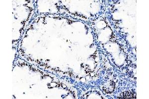 IHC analysis of CPSF6 using anti-CPSF6 antibody (ABIN7601897).