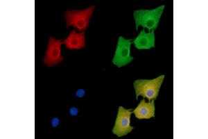 ABIN7096425 and ABIN7100489 staining  cells by IF/ICC.
