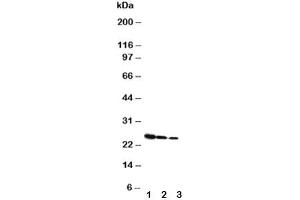 Western blot testing of Growth Hormone antibody and Lane 1:  Recombinant rat GH protein 10ng (Growth Hormone 1 Antikörper  (AA 27-216))