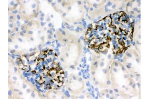 Immunohistochemistry (IHC) image for anti-Nestin (NES) (AA 252-290), (N-Term) antibody (ABIN3044529)