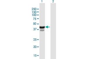 Western Blot analysis of HPR expression in transfected 293T cell line by HPR MaxPab polyclonal antibody. (HPR Antikörper  (AA 1-348))