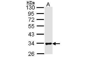 WB Image Sample (30 ug of whole cell lysate) A: Hela 10% SDS PAGE antibody diluted at 1:1000 (FHL1 Antikörper  (C-Term))