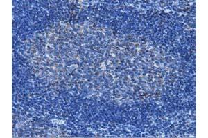 Immunohistochemical staining of paraffin-embedded Human lymph node tissue using anti-IVD mouse monoclonal antibody. (IVD Antikörper)
