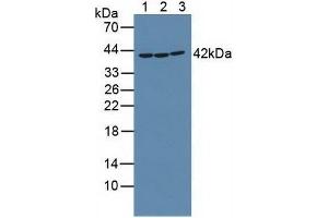 Western blot analysis of (1) Mouse Placenta Tissue, (2) Rat Placenta Tissue and (3) Human K562 Cells. (RIPK2 Antikörper  (AA 432-540))