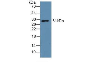 Detection of Recombinant GAL3, Mouse using Polyclonal Antibody to Galectin 3 (GAL3) (Galectin 3 Antikörper)
