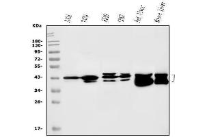 Western blot analysis of SBCAD/ACADSB using anti-SBCAD/ACADSB antibody (ABIN7602837).