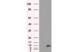 Image no. 1 for anti-Inhibitor of DNA Binding 3, Dominant Negative Helix-Loop-Helix Protein (ID3) antibody (ABIN1498778)