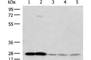 Western blot analysis of Human cerebella tissue Human cerebrum tissue Human skin tissue NIH/3T3 cell SKOV3 cell lysates using OVOL2 Polyclonal Antibody at dilution of 1:350 (OVOL2 Antikörper)