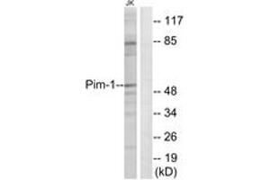 Western blot analysis of extracts from Jurkat cells, using Pim-1 (Ab-309) Antibody. (PIM1 Antikörper  (AA 281-330))