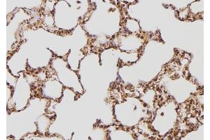 ABIN6274169 at 1/100 staining Rat lung tissue by IHC-P. (TPT1 Antikörper  (Internal Region))