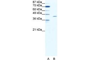 WB Suggested Anti-TAL1 Antibody Titration:  1. (TAL1 Antikörper  (C-Term))