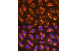 Immunofluorescence (IF) image for anti-IMP (Inosine 5'-Monophosphate) Dehydrogenase 2 (IMPDH2) antibody (ABIN7267852)