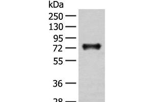 Western blot analysis of Mouse brain tissue lysate using KAT14 Polyclonal Antibody at dilution of 1:300 (KAT14 Antikörper)