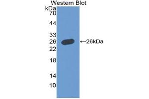 Western blot analysis of the recombinant protein. (Growth Hormone 1 Antikörper  (AA 28-217))
