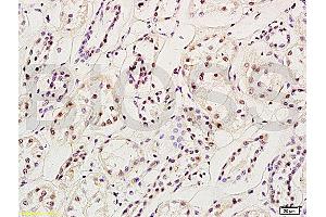 Formalin-fixed and paraffin embedded: rat brain tissue labeled with Anti-MGMT Polyclonal Antibody (ABIN730768), Unconjugated at 1:200, followed by conjugation to the secondary antibody and DAB staining (MGMT Antikörper  (AA 101-207))