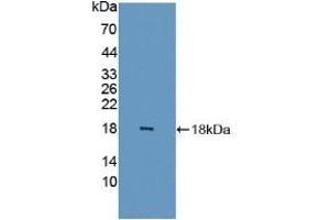 Detection of Recombinant FABP6, Human using Polyclonal Antibody to Fatty Acid Binding Protein 6, Ileal (FABP6) (FABP6 Antikörper  (AA 1-128))