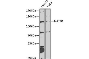 Western blot analysis of extracts of various cell lines, using N antibody (ABIN6132968, ABIN6144376, ABIN6144377 and ABIN6223123) at 1:1000 dilution. (NAT10 Antikörper  (AA 1-250))