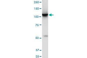 HK2 monoclonal antibody (M01), clone 4H1. (Hexokinase 2 Antikörper  (AA 818-917))