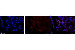 Rabbit Anti-PARL Antibody     Formalin Fixed Paraffin Embedded Tissue: Human Lung Tissue  Observed Staining: Cytoplasmic in alveolar type I cells  Primary Antibody Concentration: 1:100  Other Working Concentrations: 1/600  Secondary Antibody: Donkey anti-Rabbit-Cy3  Secondary Antibody Concentration: 1:200  Magnification: 20X  Exposure Time: 0.