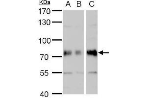 WB Image DMPK antibody detects DMPK protein by western blot analysis. (DMPK Antikörper  (Center))