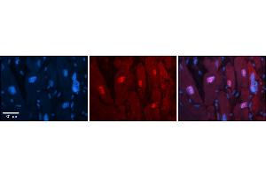 Rabbit Anti-Arih2 Antibody  Catalog Number: ARP57936_P050 Formalin Fixed Paraffin Embedded Tissue: Human Adult heart  Observed Staining: Nuclear Primary Antibody Concentration: 1:100 Secondary Antibody: Donkey anti-Rabbit-Cy2/3 Secondary Antibody Concentration: 1:200 Magnification: 20X Exposure Time: 0. (ARIH2 Antikörper  (C-Term))