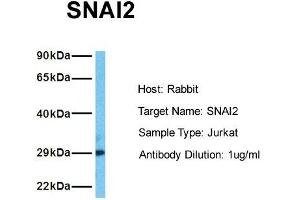 Host: Rabbit Target Name: SNAI2 Sample Tissue: Human Jurkat Antibody Dilution: 1. (SLUG Antikörper  (Middle Region))