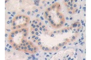 Immunohistochemistry (IHC) image for anti-C-Type Lectin Domain Family 4, Member M (CLEC4M) (AA 242-399) antibody (ABIN7441907)