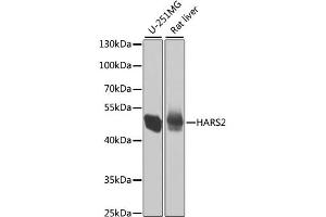 Western blot analysis of extracts of various cell lines, using HARS2 antibody.